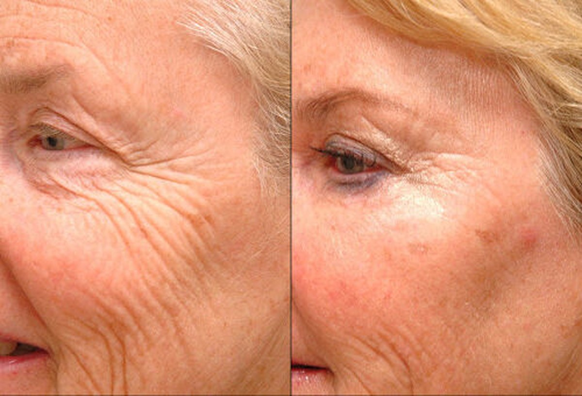 Starý ručník a ledová voda: trik kadeřnic na vrásčitý plátno - image 1